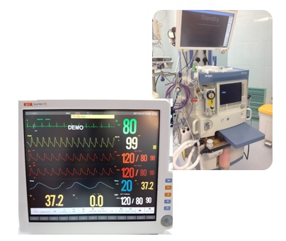 Standard anesthesia monitors